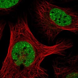 SAFB Antibody, Novus Biologicals:Antibodies:Primary Antibodies